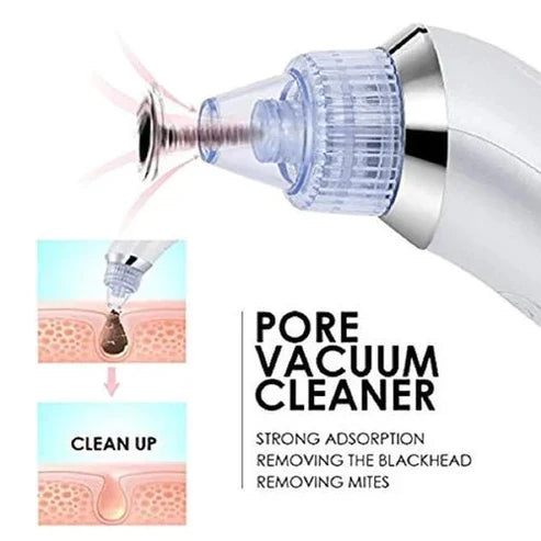 4in1 Suction Pore Cleaner, Health and Beauty 